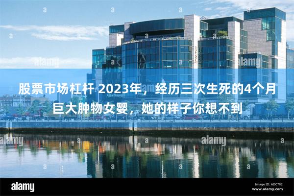 股票市场杠杆 2023年，经历三次生死的4个月巨大肿物女婴，她的样子你想不到